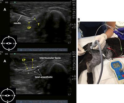 Case Report: Ultrasound Sciatic and Saphenous Nerve Blocks for Tibial Malunion Surgical Correction in a Pediatric African Leopard (Panthera pardus)